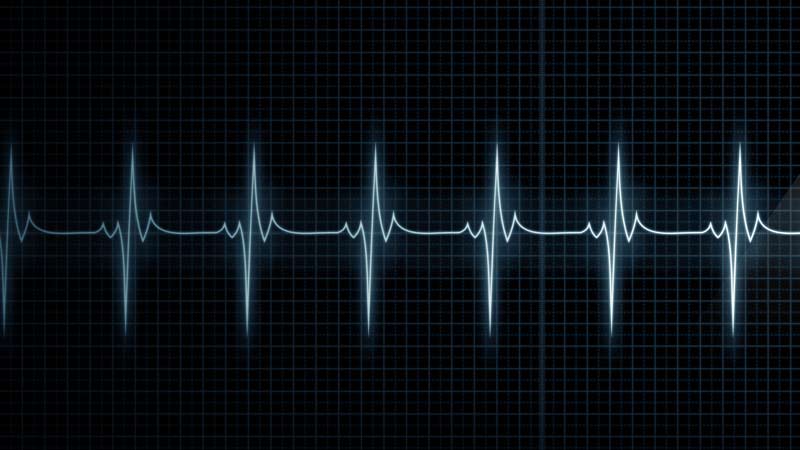 Heart Rate Variability Chart|HRV Data Set|Progressive HRV Trend|HRV Swim Data Set|Collegiate Runner HRV Data|HRV Fluctuations