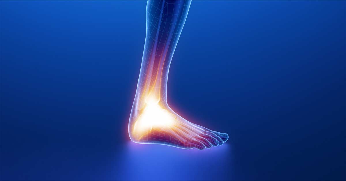 Tendon Rupture|Medications|Achilles Tendon|Achilles Surgery|Text warning about the risks associated with fluoroquinolones like FLOXIN (ofloxacin)